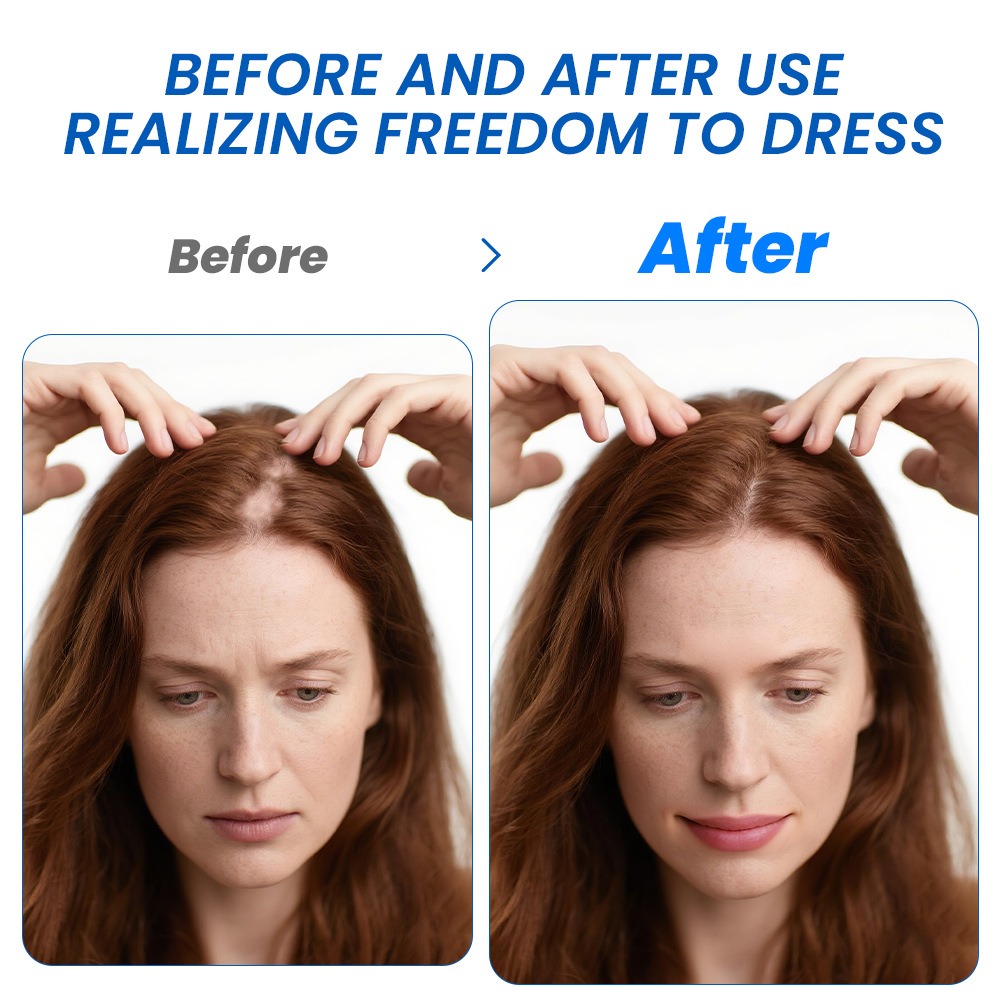 Alopecia Spray per la crescita - Hair Care Growth recensione e prezzo