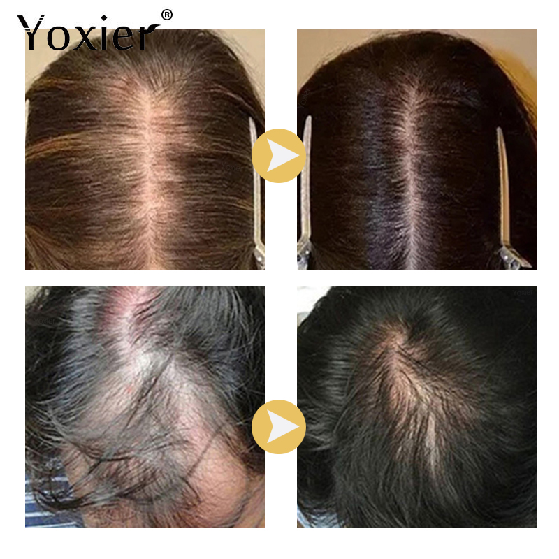 Siero per la crescita intensa  - Hair Care Serum recensione e prezzo