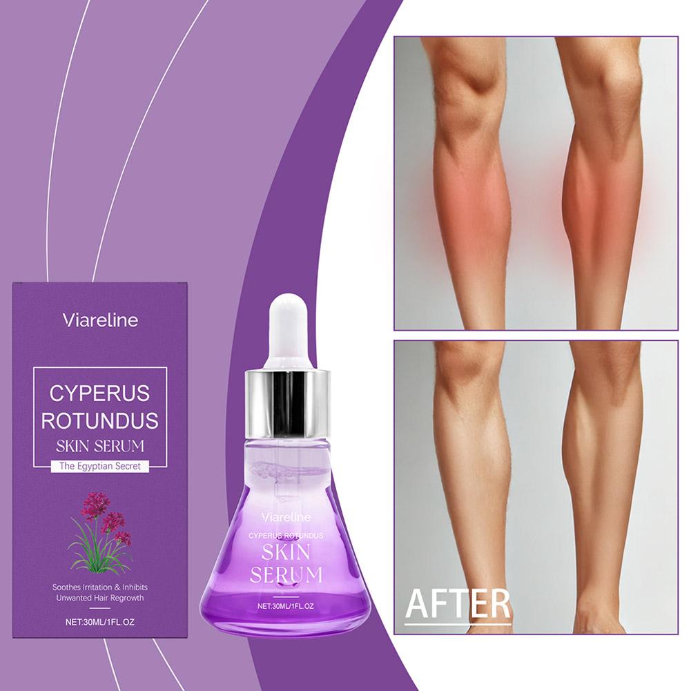 Siero Post-Epilazione Lenitivo - Hair Care Serum recensione e prezzo