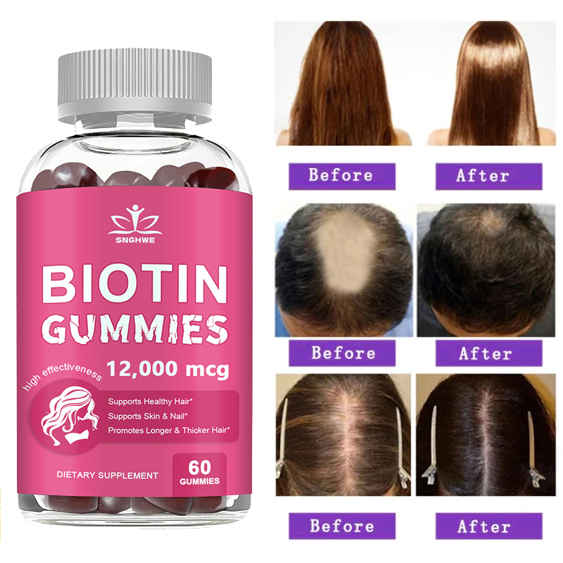 Caramelle gommose al collagene - Hair Care Gummies recensione e prezzo