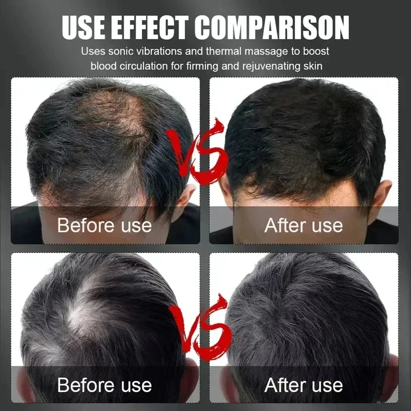 Cappello Terapeutico per la Cr - Hair Care Growth recensione e prezzo